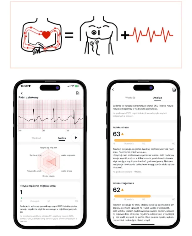 GARIS GS70 - Pomiar EKG - 3.jpg